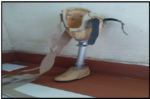 Artificial-limb2.png